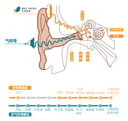 贝利视通骨听眼镜