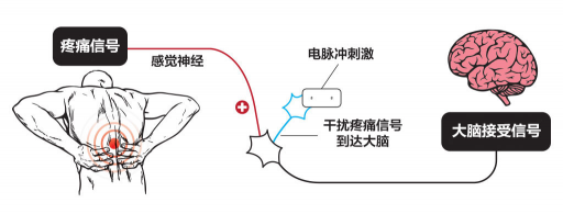 【ZE科普】一样是电，为什么名字如此花哨