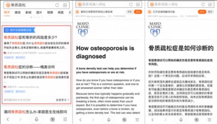 骨质疏松你真的了解吗？搜狗搜索教你正确守护骨骼健康