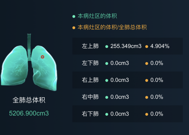 平安科技入选工信部抗疫表现突出企业 新冠肺炎AI阅片助力重点疫区