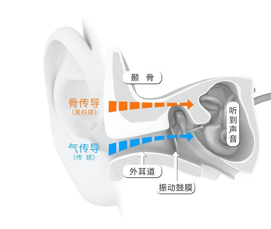 成都耳机展启示录：骨传导成为耳机行业风口