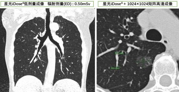 飞利浦智创科技，助力基层抗疫