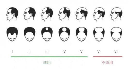 小米众筹销量惊人的可思美激光生发帽，真的能生发吗？