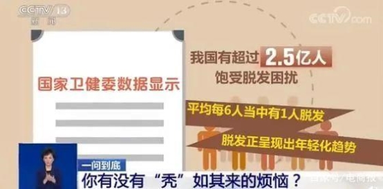 平均每5个成年人中就有1位脱发 昆明新生3D植发备受欢迎