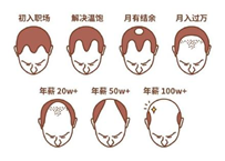 2.5亿人被脱发困扰？Rogaine培健实力生发