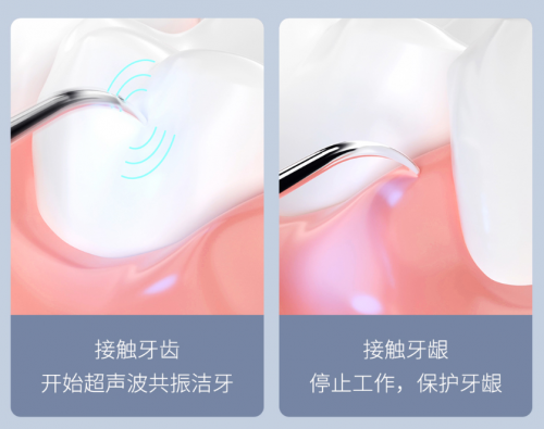 年轻人爱美从牙齿开始，这款199的口腔护理神器太值了，买它！