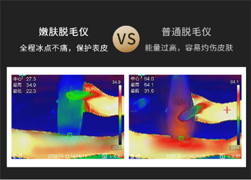 Ulike脱毛仪：硬核蓝宝石级别，才是真正的冰点无痛