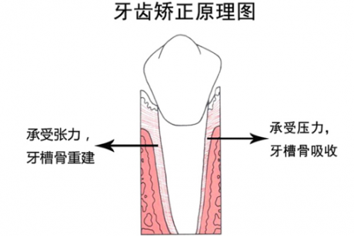 3D数字化模型矫牙“神器”，让你不惧年龄“矫”傲逆袭