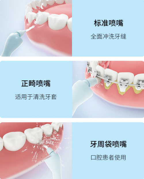 可视冲牙+神仙颜值！这才是年轻人想要的冲牙器