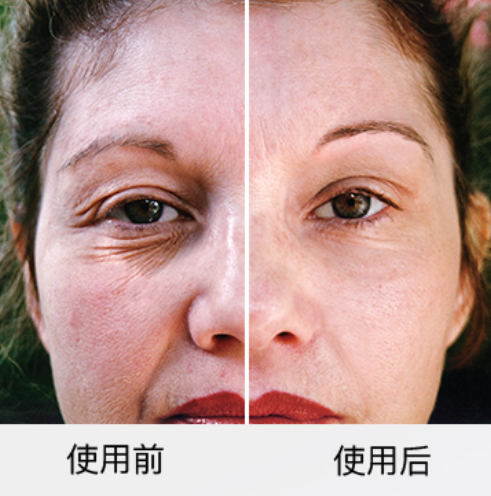 DermaWand Pro逆龄射频活氧棒在家里也能享受到的轻医美