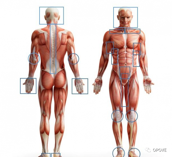 什么是肌筋膜炎？OPOVE筋膜枪你知道多少？