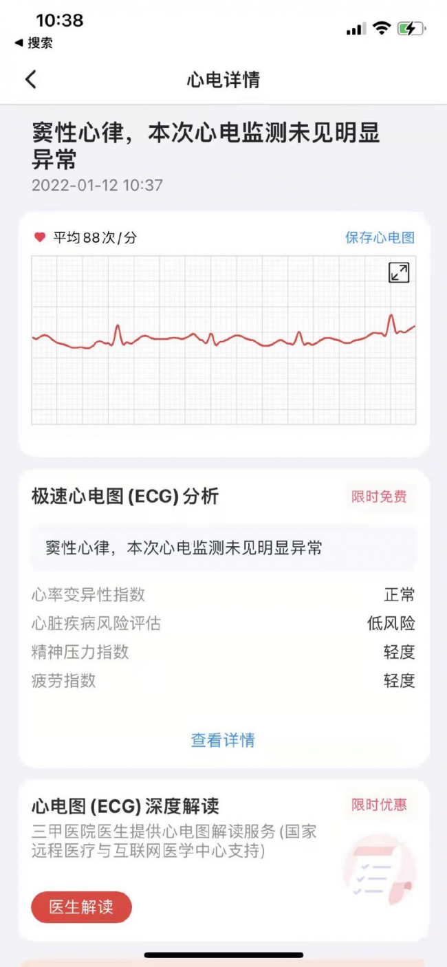 春节市场健康类产品升温 心脏+APP
评测