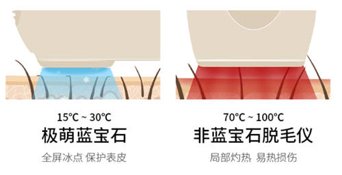 发力科技研发再次升级迭代 2022新款Ulike脱毛仪登场