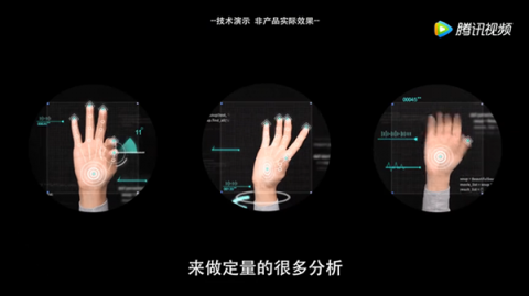 世界帕金森病日：腾讯AI有望成为300万患者的移动专属“医生”