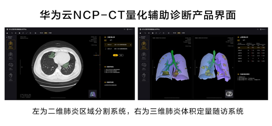 华为云推出新冠肺炎AI辅助诊断服务，疫情期间免费对定点收治医院开放