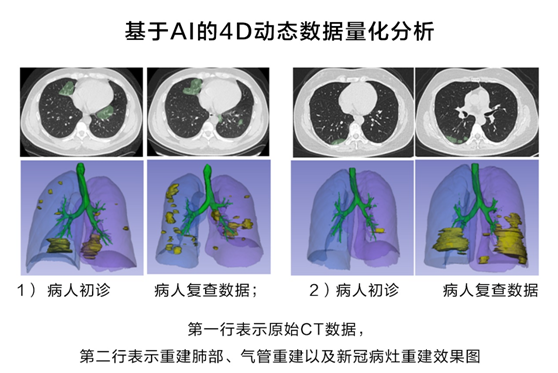 华为云推出新冠肺炎AI辅助诊断服务，疫情期间免费对定点收治医院开放