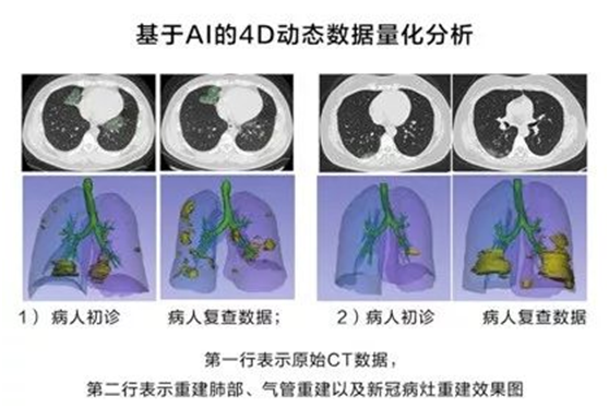 非常时期下的城市防控、生产与治理，华为云用AI“全链条“战疫